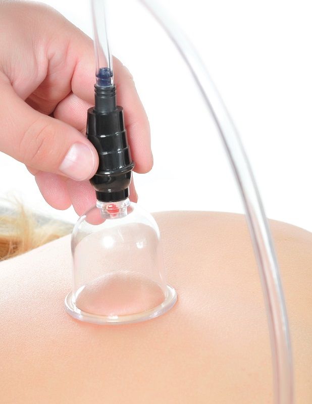 Fetish Fantasy Series - 6-piece Suction Set